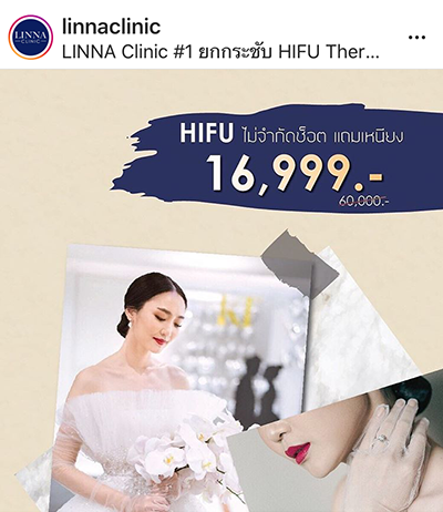 เรื่องความงาม กับเจ้าสาว เป็นเรื่องที่สำคัญ สาวๆ ทุกคนก็อยากให้ตัวเองดูสวยที่สุดในงาน wedding เรามีตัวช่วยมืออาชีพ ที่จะมาเนรมิตร ความงามให้กับสาวๆนะคะ